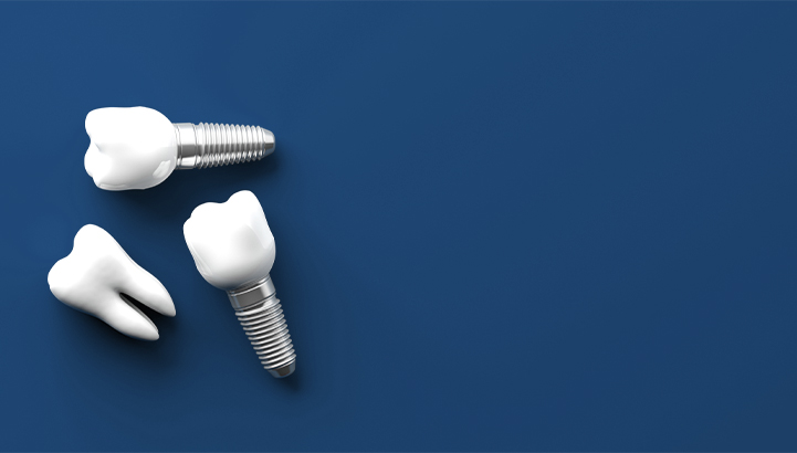 Dental Implants